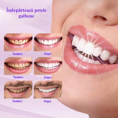 Pastă pentru Albirea Dinților V34 HYSMILE